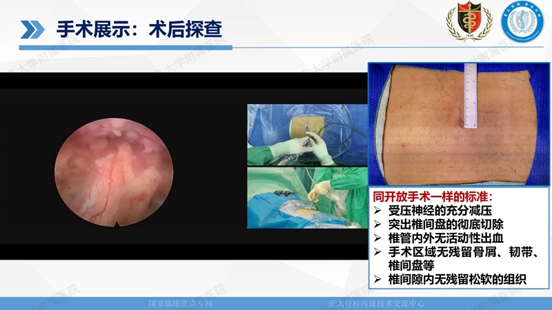 1. ULBD技术体系构建及临床应用 2023.4.5 - 15min_116.jpg