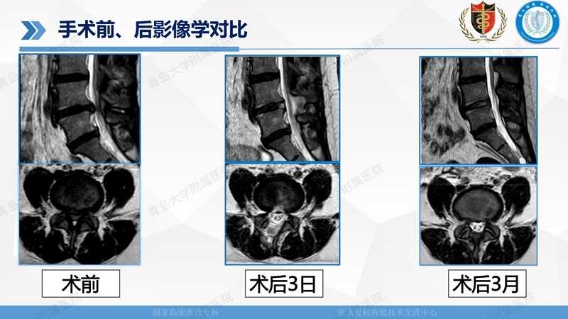 1. ULBD技术体系构建及临床应用 2023.4.5 - 15min_118.jpg