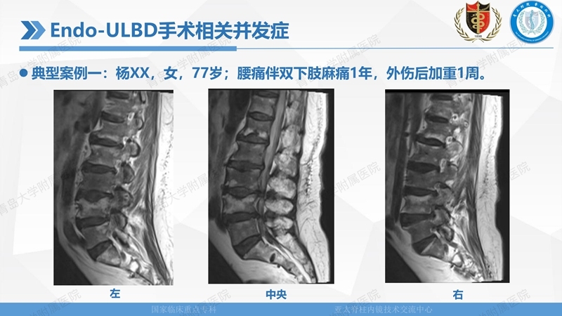 1. ULBD技术体系构建及临床应用 2023.4.5 - 15min_124.jpg