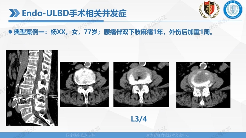 1. ULBD技术体系构建及临床应用 2023.4.5 - 15min_122.jpg