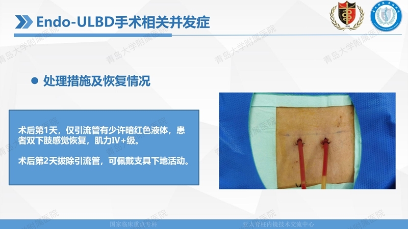 1. ULBD技术体系构建及临床应用 2023.4.5 - 15min_130.jpg