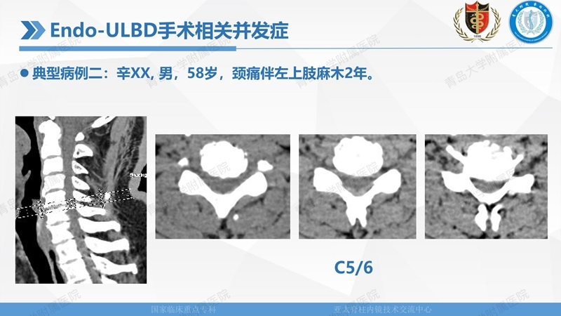 1. ULBD技术体系构建及临床应用 2023.4.5 - 15min_138.jpg