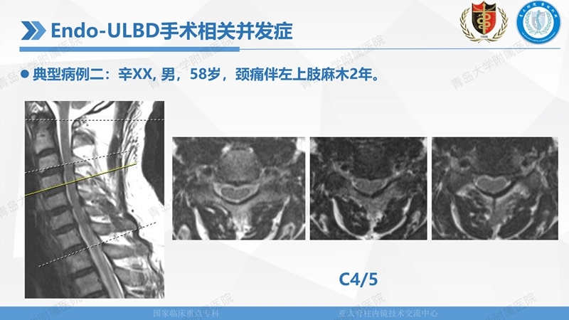 1. ULBD技术体系构建及临床应用 2023.4.5 - 15min_139.jpg