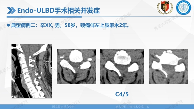 1. ULBD技术体系构建及临床应用 2023.4.5 - 15min_142.jpg