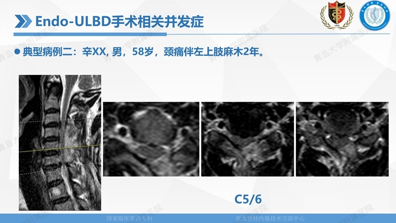 1. ULBD技术体系构建及临床应用 2023.4.5 - 15min_145.jpg