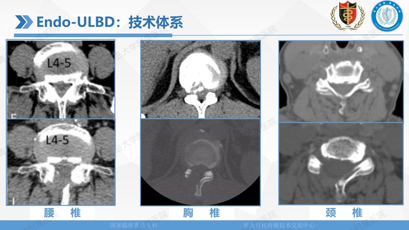 1. ULBD技术体系构建及临床应用 2023.4.5 - 15min_147.jpg